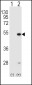 FDFT1 Antibody (N-term)